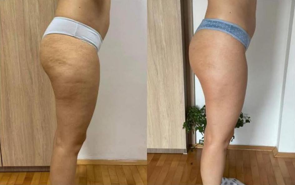 Vauslim48 - Super Skin Body Reset