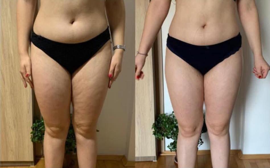 Super Skin Body Reset